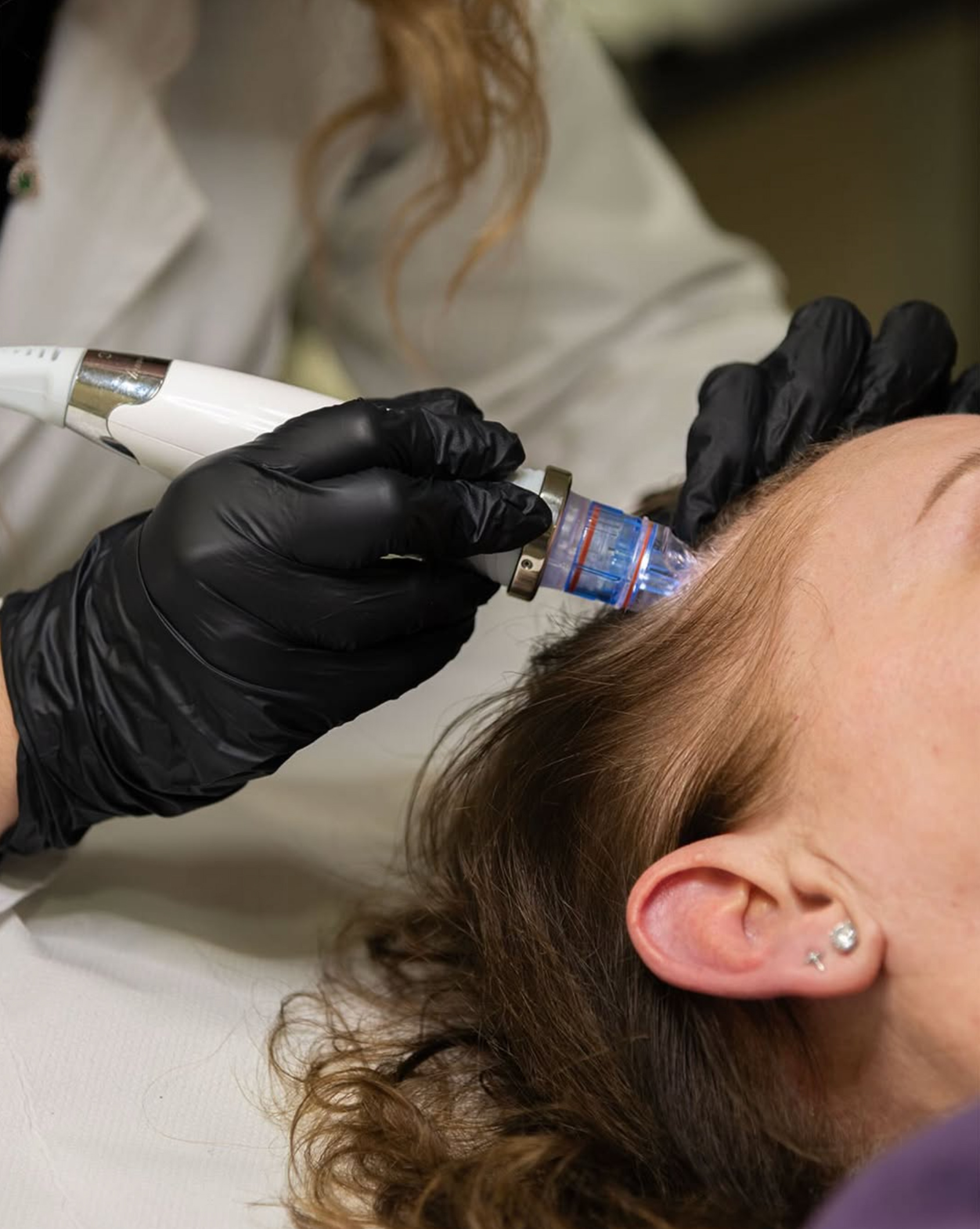 Valoración capilar en Clínica Aleu para estudiar el estado del cuero cabelludo y diseñar un tratamiento personalizado.