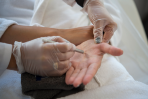 Tratamiento para la hiperhidrosis en Clínica Aleu para ayudar a controlar la sudoración excesiva en Algeciras