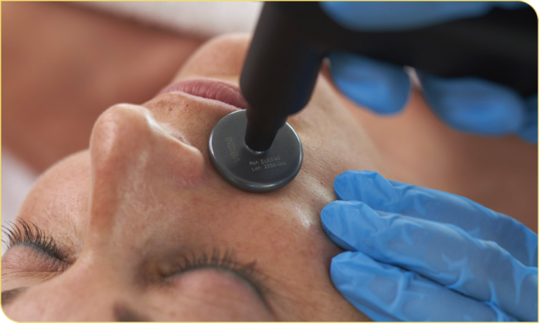 indiba-tratamientos-facial-768x461-1